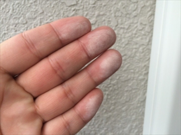 外壁にチョーキング