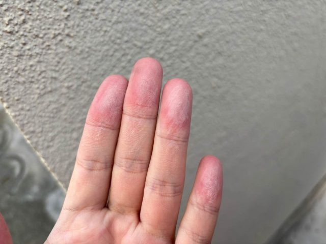 筑紫野市の外壁で見つかったチョーキング