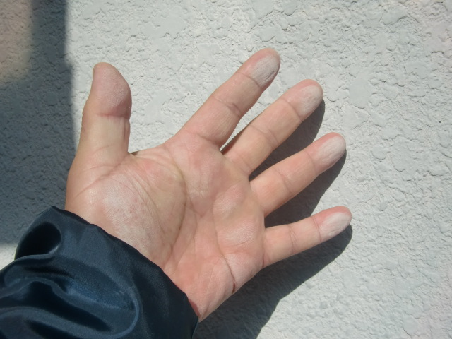 和歌山市善明寺の外壁のチョーキング