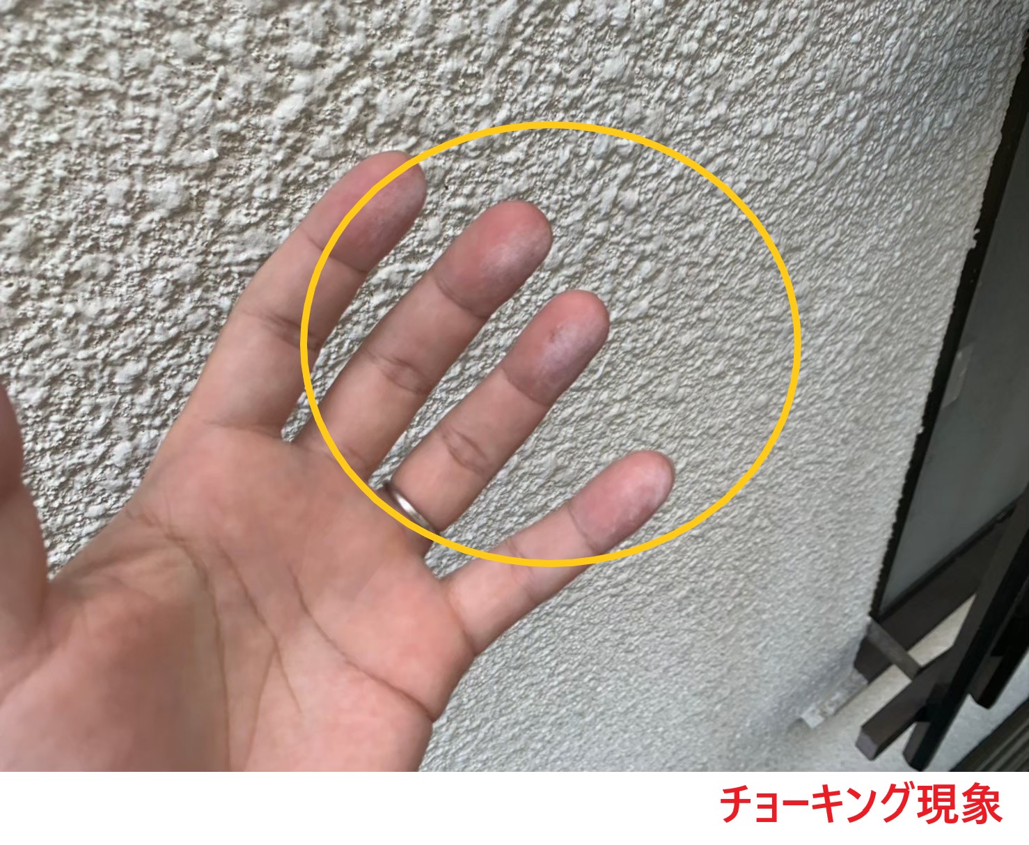 チョーキング現象