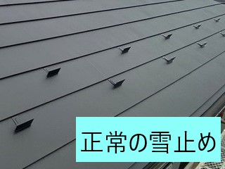 正常の雪止め