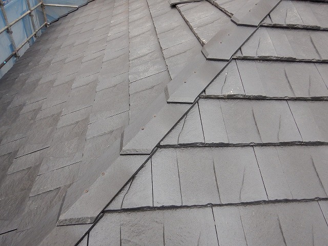 差し棟冠の取り付け