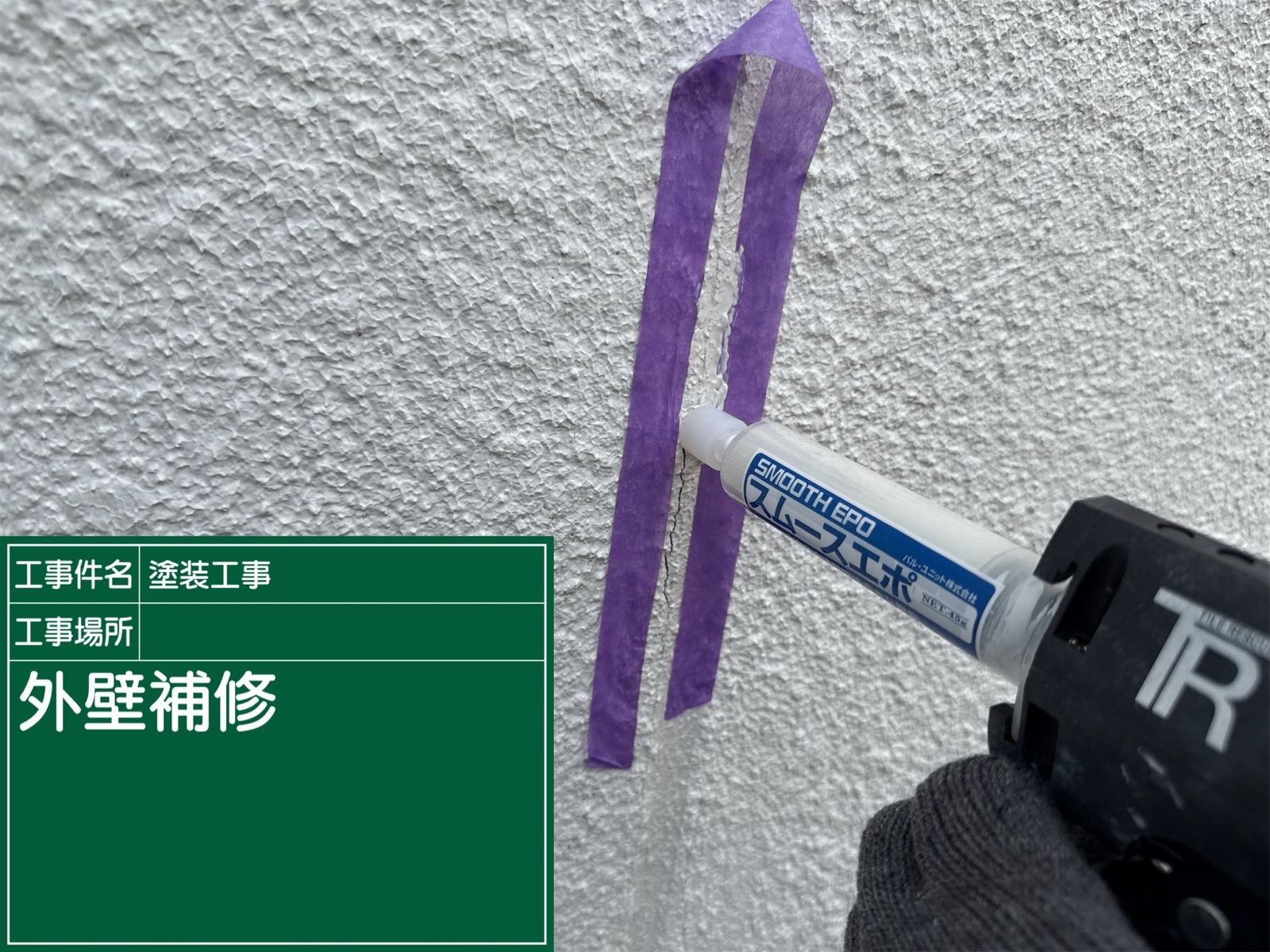 スムースエポ注入