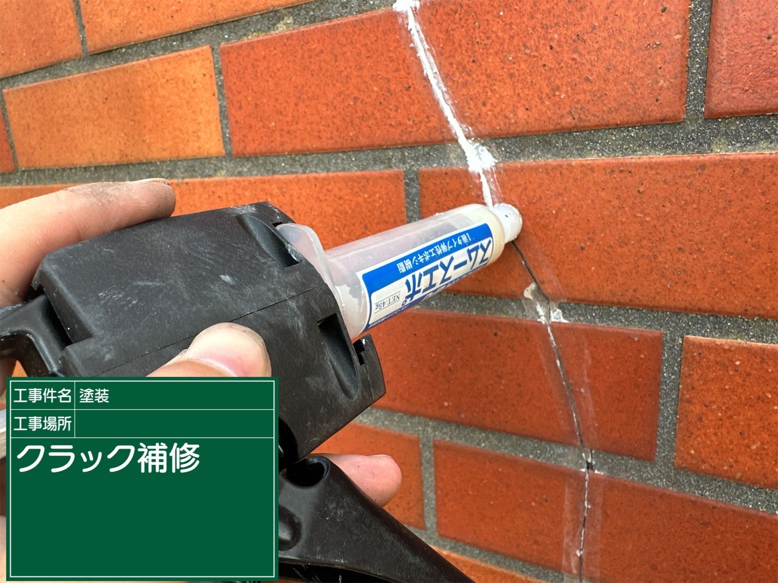 スムースエポ注入