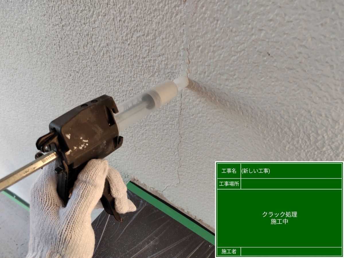 スムースエポ注入